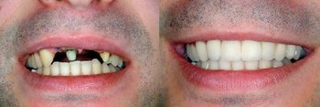 Smile Gallery - Galleria Dental, Mundelein Dentist